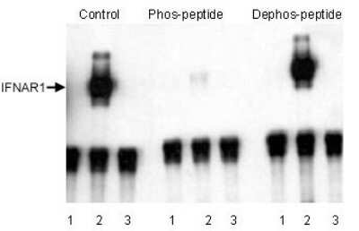 Western Blot: IFN-alpha/beta R1 [p Ser535, p Ser539] Antibody [NB300-258]